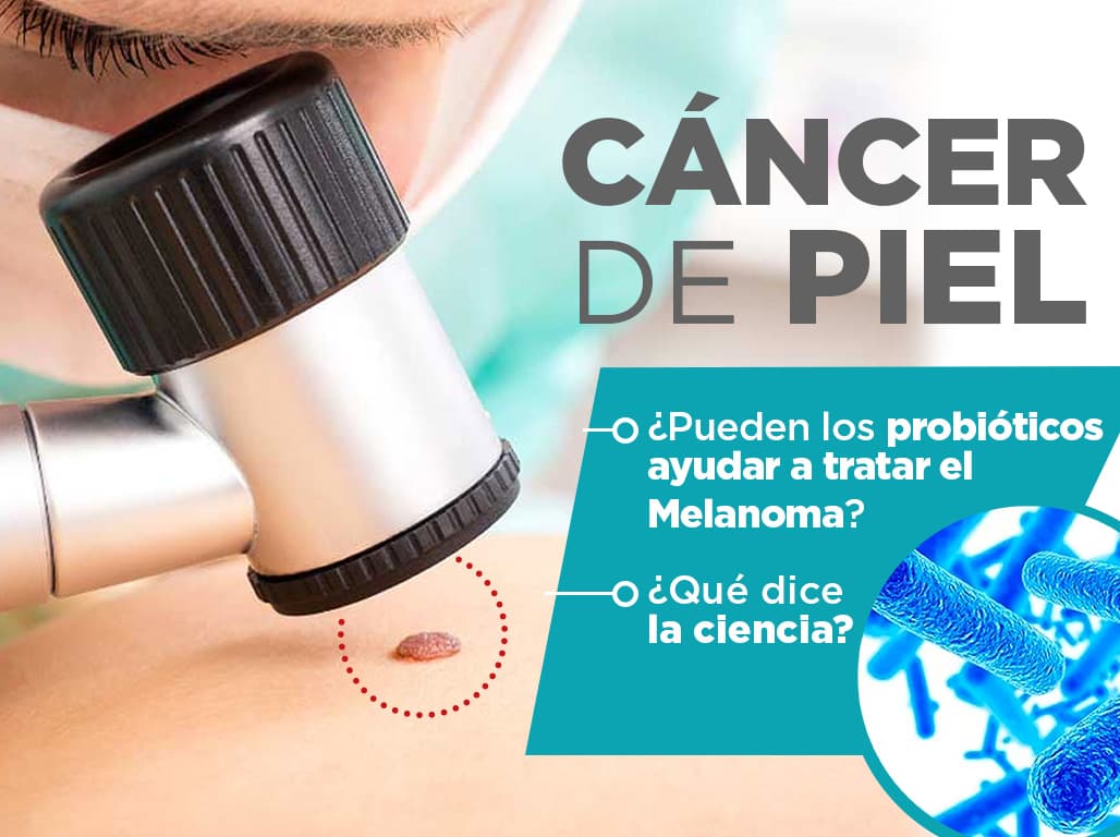 Lee más sobre el artículo Cáncer de piel. ¿Pueden los probióticos ayudar a tratar el melanoma? ¿Qué dice la ciencia?
